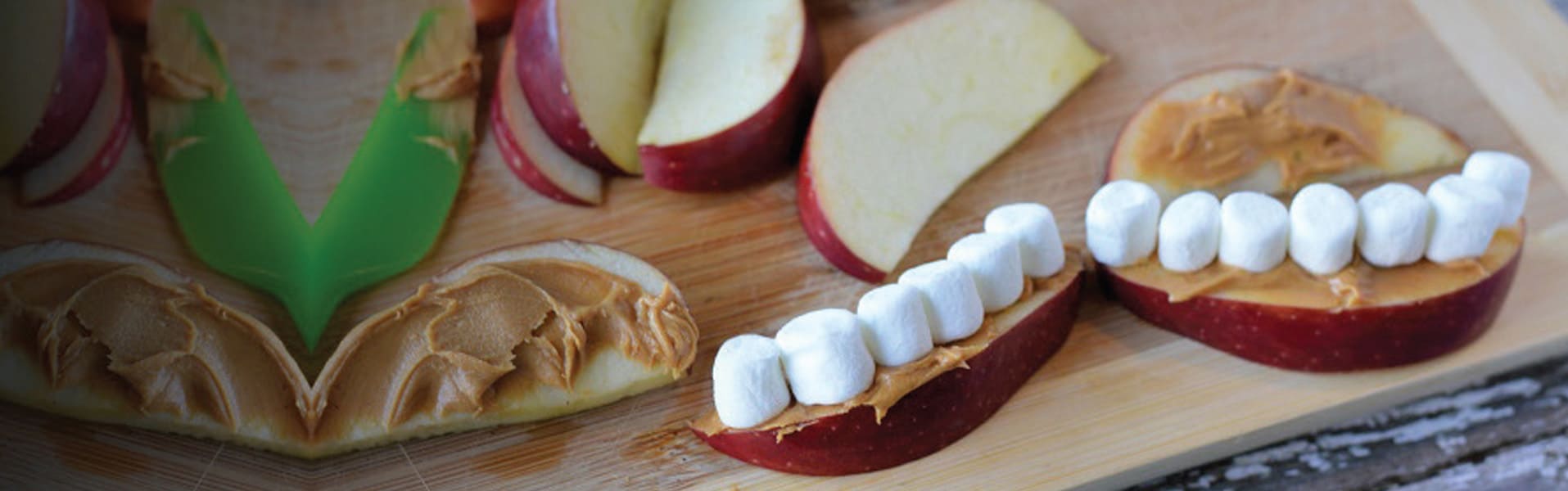Apple Peanut Butter Teeth / Fun Easy Kid’s Snack Rocky Mountain